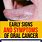 Tongue Cancer Early Signs