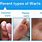 Types of Warts Images