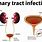 Urinary Tract Infection Discharge