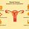 Uterine Fibroid Tumors