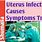 Uterus Infection