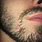 Vellus Hair Beard