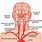 What Is Carotid Artery