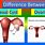 What Is an Adnexal Cyst