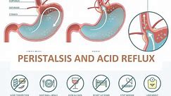 PERISTALSIS AND ACID REFLUX | how to know that you have stomach disease #peristalsis