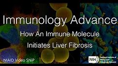 Immunology Advance: How An Immune Molecule Initiates Liver Fibrosis