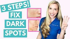 Fix Your Dark Spots in 3 Steps! | Hyperpigmentation | Melasma | Skincare Made Simple