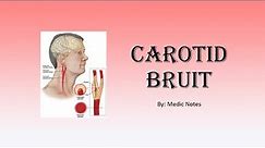 Carotid bruit - causes, pathophysiology, sign value