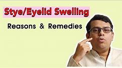 Stye | Eyelid Swellings | Reasons & Remedies