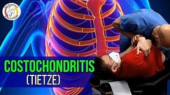 Costochondritis (Tietze) Chiropractic Evaluation & Treatment | Synergy Wellness Chiropractic NYC