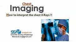 Chest X-ray techniques & terminology - Prof. Mamdouh Mahfouz