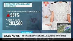 Syphilis cases continue to surge in U.S., CDC says