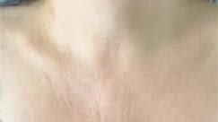 Forehead Patch 🤝 getting rid of forehead wrinkles. . #eyesheetmask #botoxalternative #wrinkleprevention #wrinklereduction #eyewrinklepatch #eyebags #skincarethatsticks #wrinkletreatment #siliconepatch #wrinklepatch #darkcircles | Baby Trends