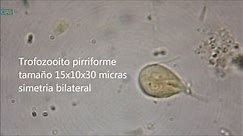 Giardia lamblia, also known as... - All Things Microbial