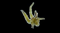 Larva of sea anemone Actiniaria under microscope, class Anthozoa, phylum Cnidaria. Looks like a sea hydra, has stinging cells that burn skin. Specimen found in Red Sea