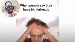 The biggest forehead ever?