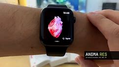INSIGHT HEART - prototype of standalone Apple Watch App