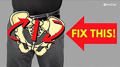 How to Fix a Rotated Pelvis in SECONDS