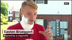 E-cigarette explodes, burns high school student