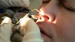 WORLDS BIGGEST BOOGER PULLED OUT OF NOSE *DISTURBING*