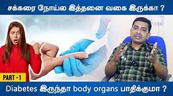 சக்கரை நோய்ல இத்தனை வகை இருக்கா? Diabetes இருந்தா Body Organs பாதிக்குமா? #Medshyne #diabetes #tamil