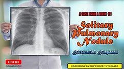 Solitary pulmonary nodule | Radiology | Differential Diagnoses