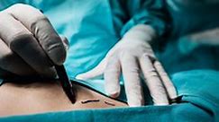 Plastic, Reconstructive, Hand & Micro-Vascular Surgery | Hurley Medical Center