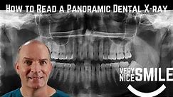 How to read a panoramic dental x ray