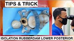 Tips and Trick Isolation With Rubberdam Lower Premolar With Double Clamp • Video • MEDtube.net
