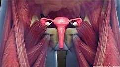 What is Intramural Uterine Fibroid: Symptoms and Treatment | 3D Guide