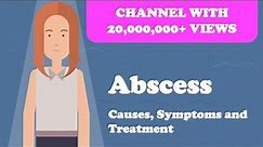 Abscess - Causes, Symptoms and Treatment