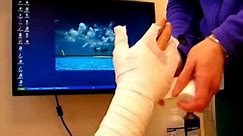 How to Make a Cast for a Hand Fracture - Nicky Leung, MD
