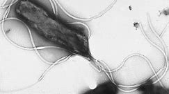 Helicobacter pylori – WikiSkripta