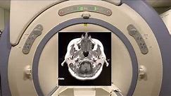 MRI Scan Sounds Explained - Exploring Brain MRI Scan Sounds and Protocols
