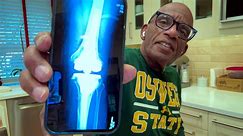 TODAY's Al Roker shares pic of new knee following surgery