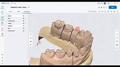 MEDIT New T series Desktop Scanners Basic course (Medit Scan for Labs, Prosthetics) (ENG)