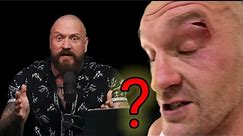 BREAKING NEWS ❗TRUE GEORDIE RESPONDS TO TYSON FURY'S (RECENT INJURY) 'ARE YOU NOT SURPRISED?'