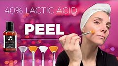 40% LACTIC ACID PEEL // FOR GLOWING HOLIDAY SKIN