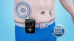 Medtronic MiniMed - How does the MiniMed 640G insulin pump work?