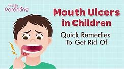Mouth Ulcers (Canker Sores) in Children - Causes, Symptoms & Treatment