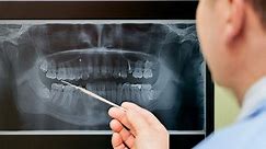 Panoramic Dental X-Ray: Why Get One, Costs, and Procedure - Dentaly.org
