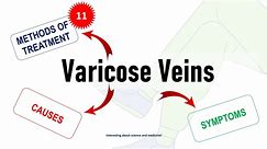Varicose Veins: 11 Treatment Methods, Causes, Symptoms, Prevention and Nutrition