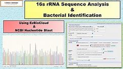 16s rRNA Sequence Analysis & Bacterial Identification Using EzBioCloud & NCBI Nucleotide Blast