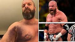 Triple H reveals brutal injury suffered in Saudi Arabia
