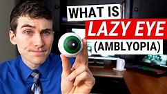 What is LAZY EYE (Amblyopia) and What Causes It