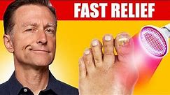 The Most Effective Therapy For Gout (High Uric Acid)