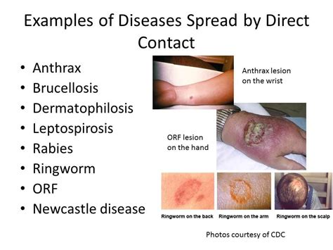 2 2 disease transmission by direct contact examples youtube