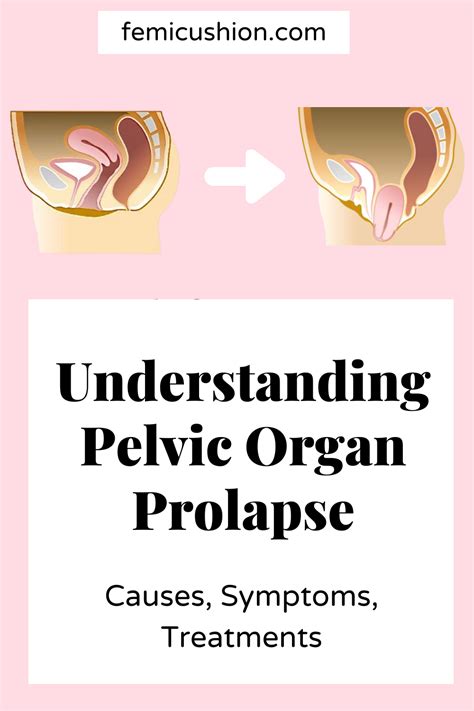 understanding pelvic organ prolapse bladder uterine rectal vaginal wall