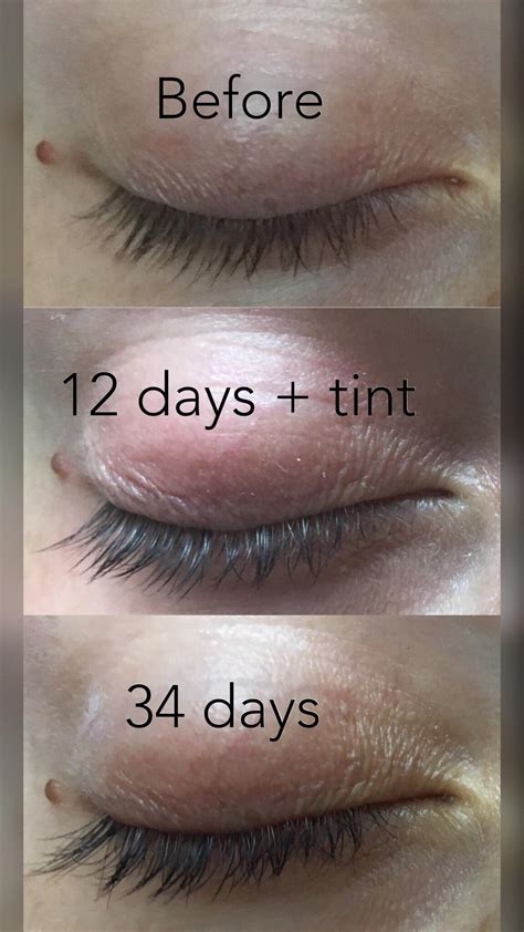 ba ive  multiple people   eyelash growth      skincare
