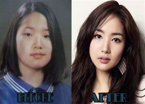 korean celebrities plastic surgery